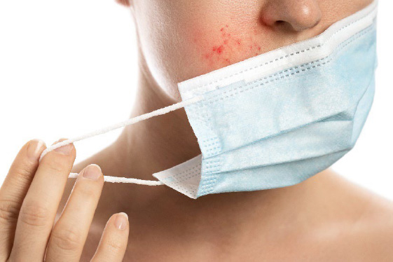 A natural substitute for silicone, which eases irritated skin with 'maskne'