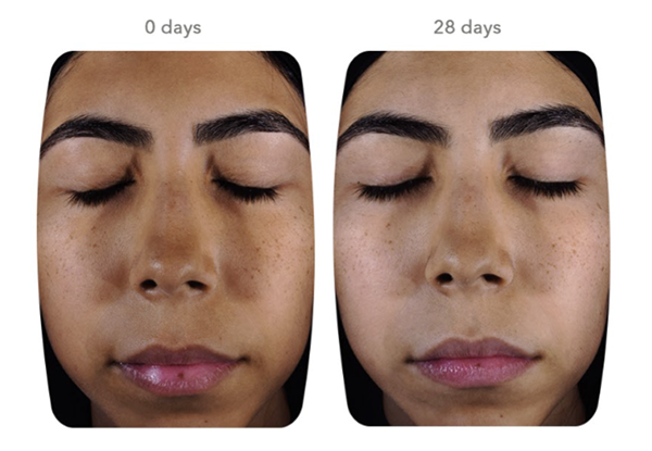 Exposome protection for beauty that lasts