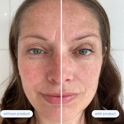 Haut.AI announces commercial availability of SkinGPT and launches interactive 'Generative Skin' experience