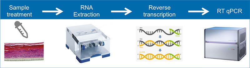 In vitro skin sensitisation evaluation: Spotlight on the SENS-IS