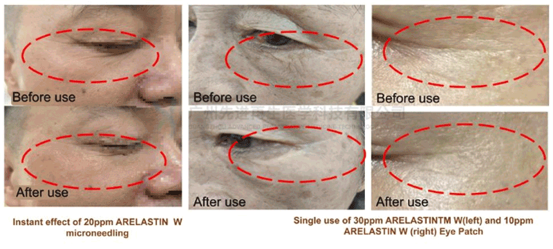 Recombinant humanised elastin: A game changer in anti-ageing technology