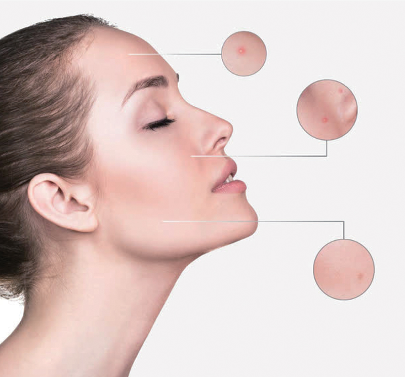 SpecKare C8G: Introducing the latest in skin care ingredients