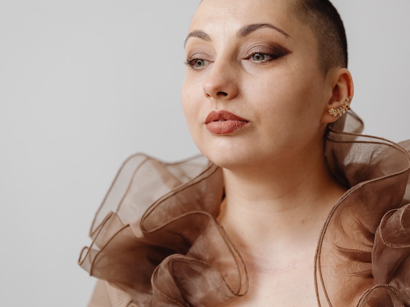 Alopecia affects 147 million people worldwide